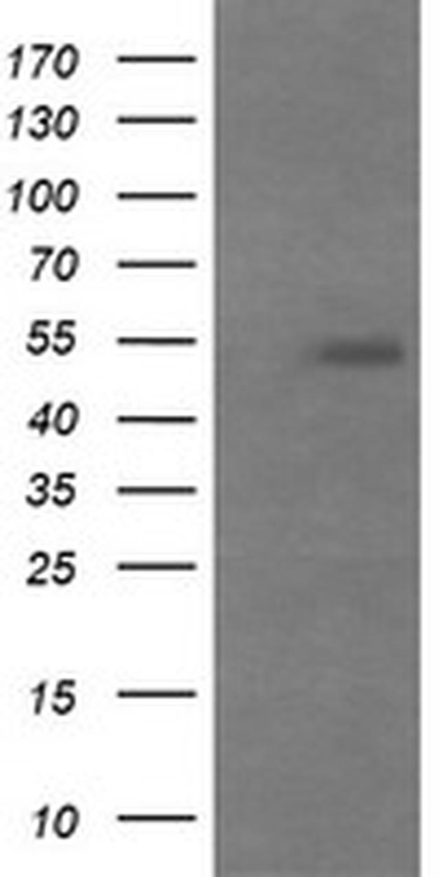 MDM4 Antibody in Western Blot (WB)