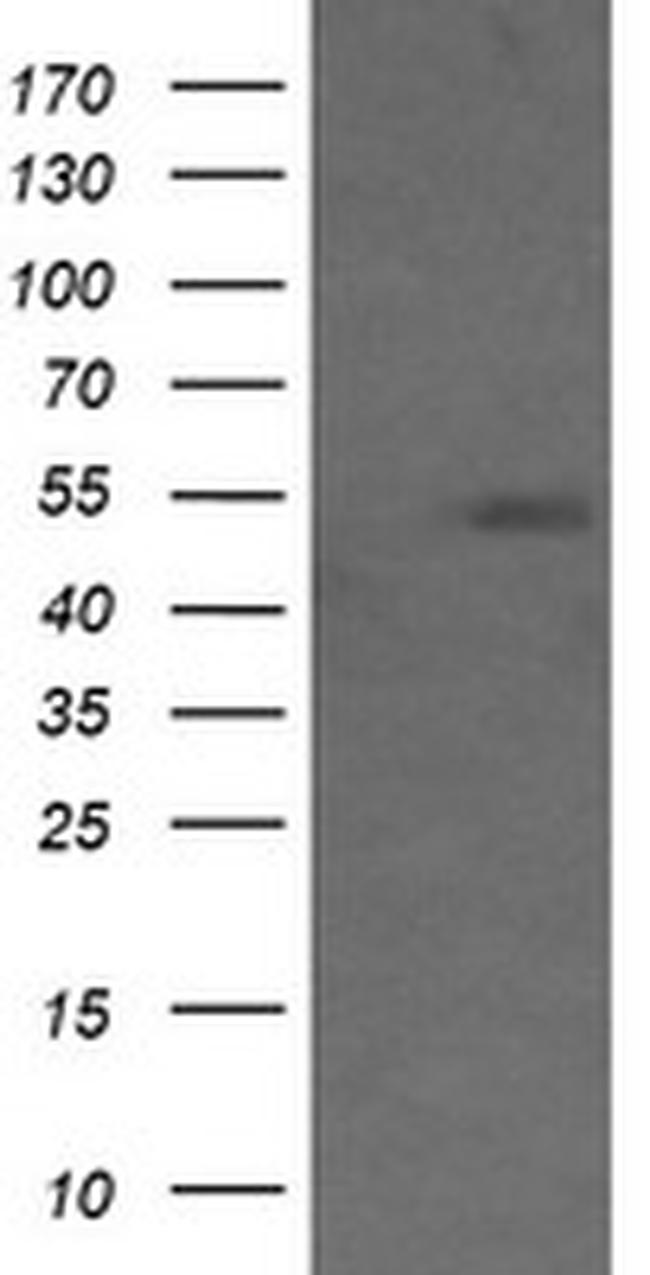 MDM4 Antibody in Western Blot (WB)