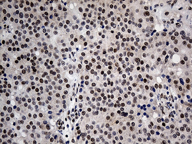 MECP2 Antibody in Immunohistochemistry (Paraffin) (IHC (P))