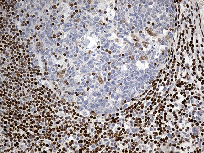 MECP2 Antibody in Immunohistochemistry (Paraffin) (IHC (P))