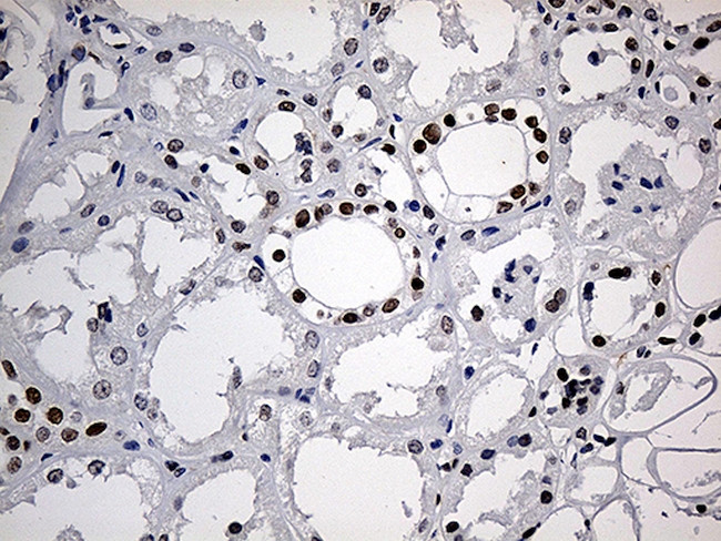 MECP2 Antibody in Immunohistochemistry (Paraffin) (IHC (P))