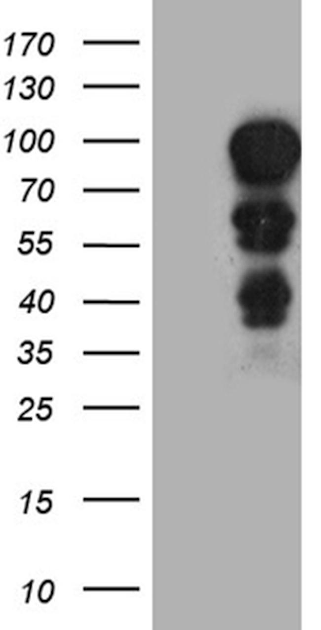 MECP2 Antibody in Western Blot (WB)