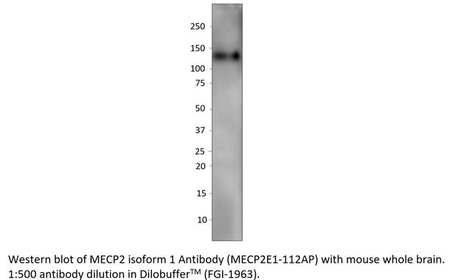 MeCP2 isoform 1 Antibody in Western Blot (WB)