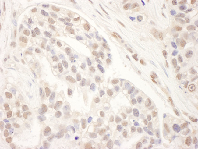 CRSP1/TRAP220 Antibody in Immunohistochemistry (IHC)