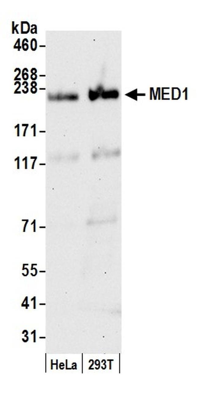 CRSP1/TRAP220 Antibody in Western Blot (WB)