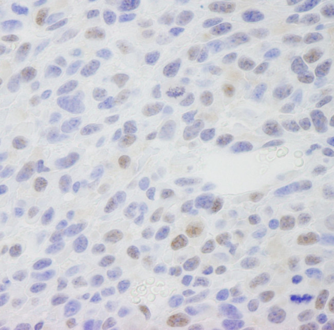 CRSP1/TRAP220 Antibody in Immunohistochemistry (IHC)