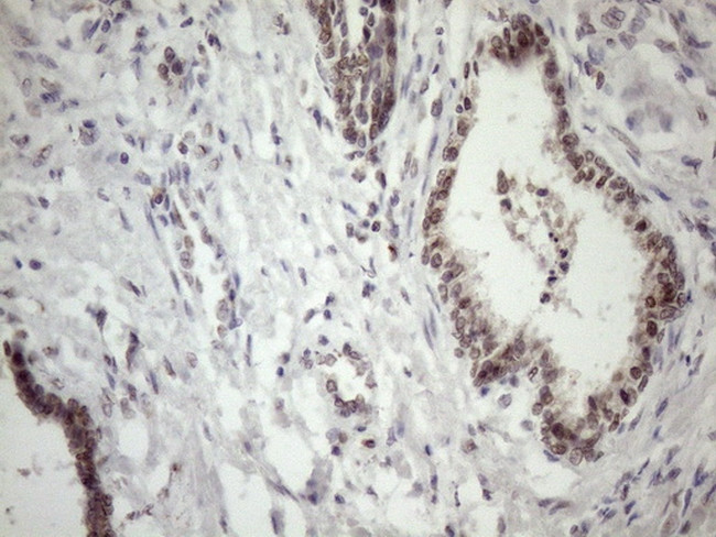 MED15 Antibody in Immunohistochemistry (Paraffin) (IHC (P))