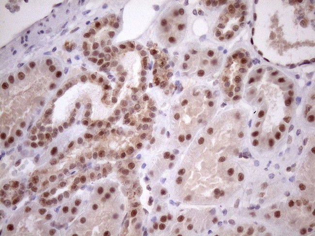 MED15 Antibody in Immunohistochemistry (Paraffin) (IHC (P))