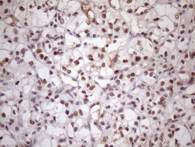 MED15 Antibody in Immunohistochemistry (Paraffin) (IHC (P))