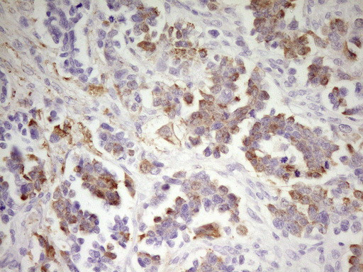 MED15 Antibody in Immunohistochemistry (Paraffin) (IHC (P))