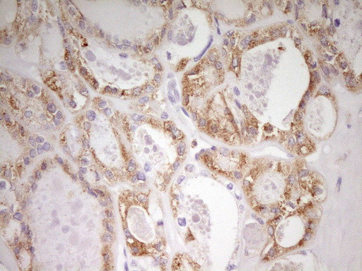 MED15 Antibody in Immunohistochemistry (Paraffin) (IHC (P))