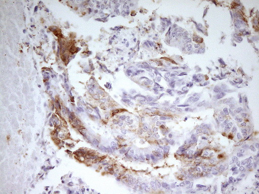 MED15 Antibody in Immunohistochemistry (Paraffin) (IHC (P))