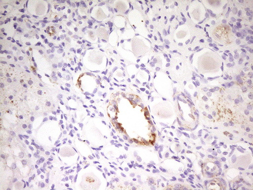 MED15 Antibody in Immunohistochemistry (Paraffin) (IHC (P))