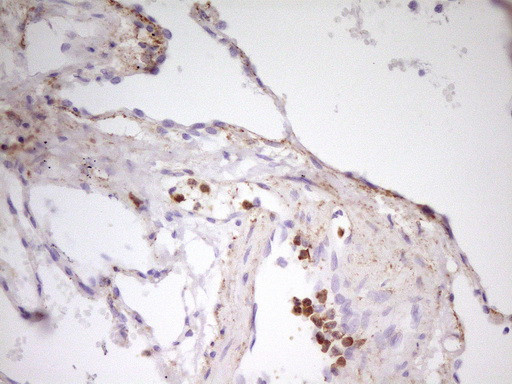 MED15 Antibody in Immunohistochemistry (Paraffin) (IHC (P))