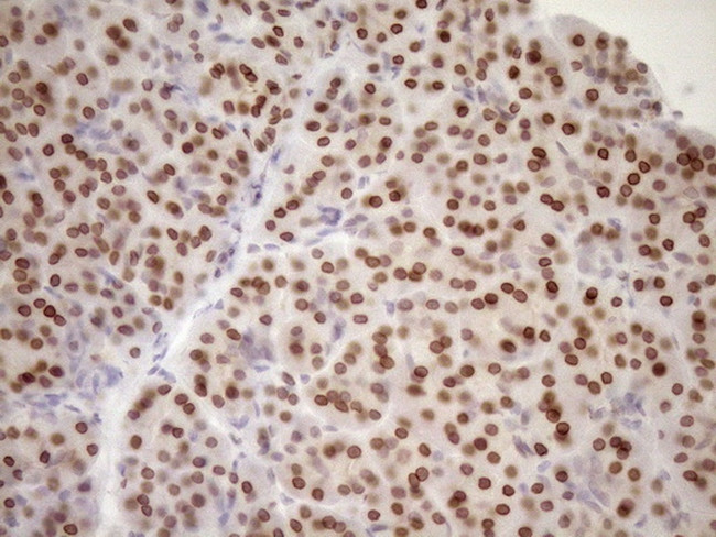 MED15 Antibody in Immunohistochemistry (Paraffin) (IHC (P))