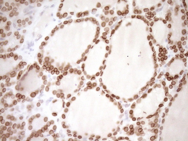 MED15 Antibody in Immunohistochemistry (Paraffin) (IHC (P))