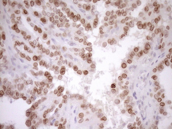 MED15 Antibody in Immunohistochemistry (Paraffin) (IHC (P))