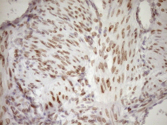 MED15 Antibody in Immunohistochemistry (Paraffin) (IHC (P))