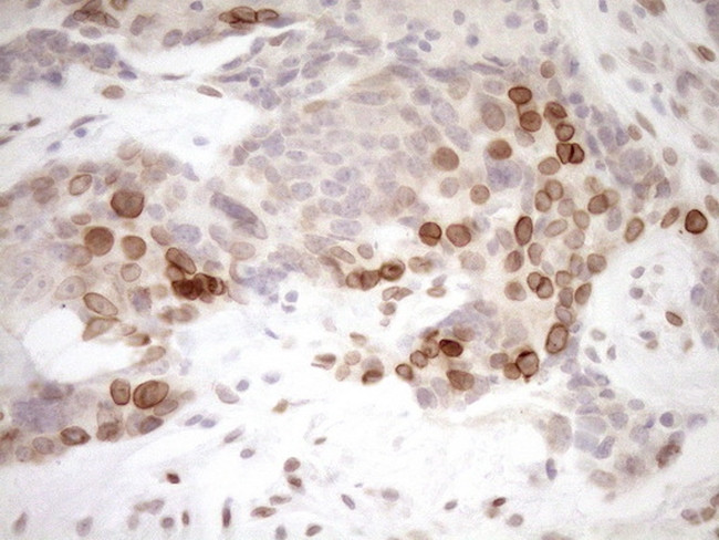 MED15 Antibody in Immunohistochemistry (Paraffin) (IHC (P))