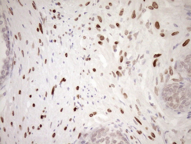 MED15 Antibody in Immunohistochemistry (Paraffin) (IHC (P))