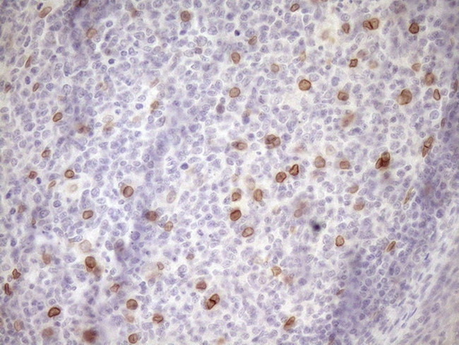 MED15 Antibody in Immunohistochemistry (Paraffin) (IHC (P))