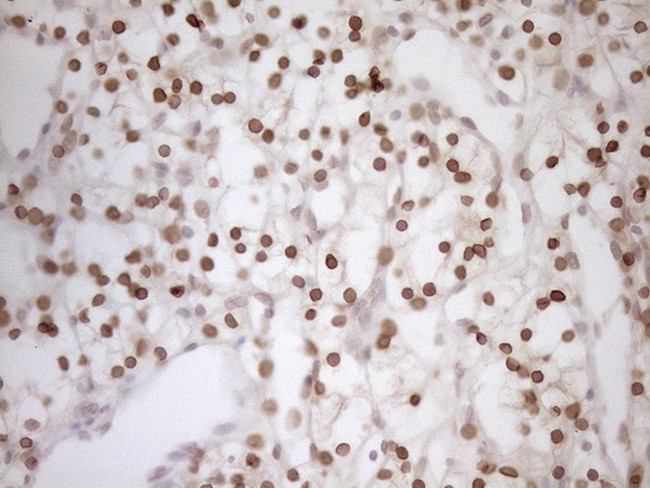 MED15 Antibody in Immunohistochemistry (Paraffin) (IHC (P))