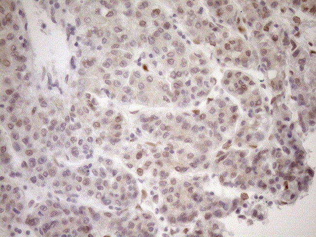 MED15 Antibody in Immunohistochemistry (Paraffin) (IHC (P))