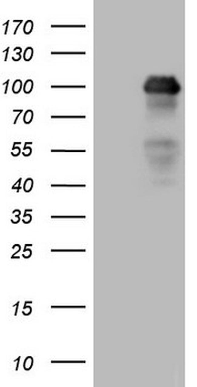 MED15 Antibody in Western Blot (WB)