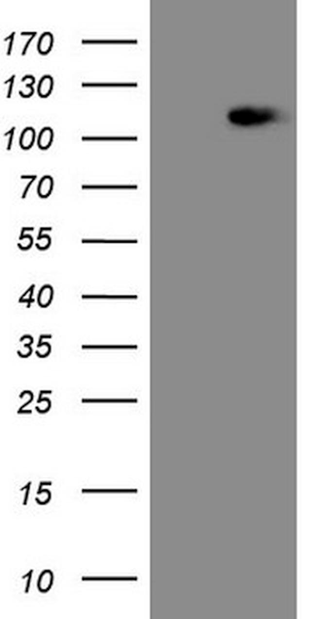 MED15 Antibody in Western Blot (WB)