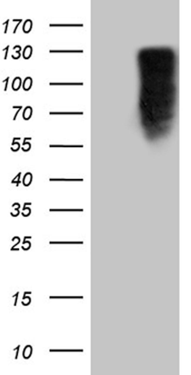 MED15 Antibody in Western Blot (WB)