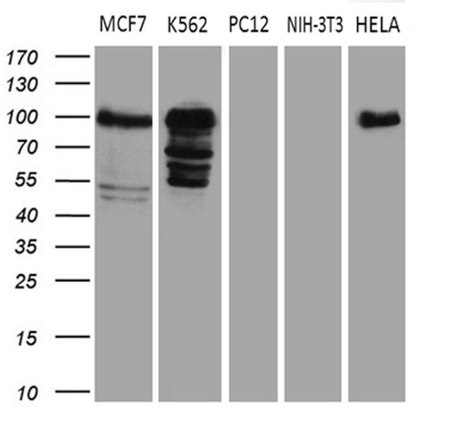 MED15 Antibody in Western Blot (WB)