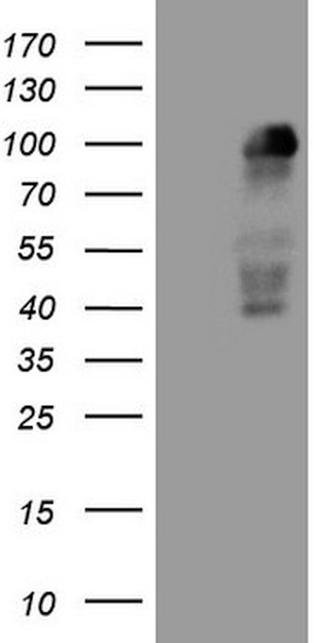 MED15 Antibody in Western Blot (WB)