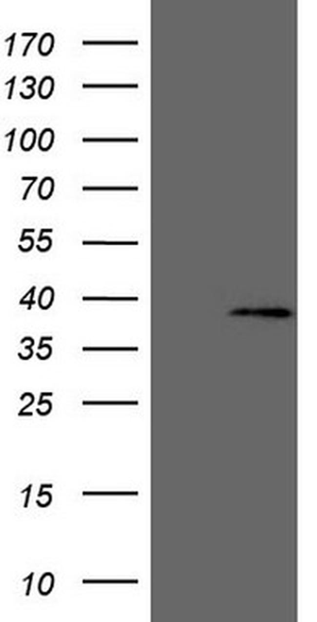 MED6 Antibody in Western Blot (WB)