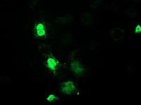 MEF2C Antibody in Immunocytochemistry (ICC/IF)