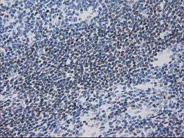 MEF2C Antibody in Immunohistochemistry (Paraffin) (IHC (P))