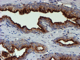 MEF2C Antibody in Immunohistochemistry (Paraffin) (IHC (P))