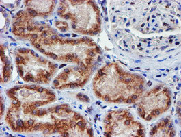 MEF2C Antibody in Immunohistochemistry (Paraffin) (IHC (P))