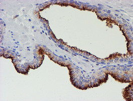 MEF2C Antibody in Immunohistochemistry (Paraffin) (IHC (P))