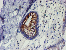 MEF2C Antibody in Immunohistochemistry (Paraffin) (IHC (P))