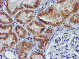 MEF2C Antibody in Immunohistochemistry (Paraffin) (IHC (P))