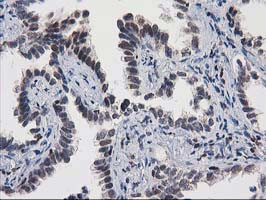 MEF2C Antibody in Immunohistochemistry (Paraffin) (IHC (P))