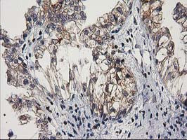 MEF2C Antibody in Immunohistochemistry (Paraffin) (IHC (P))