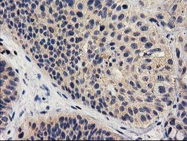 MEF2C Antibody in Immunohistochemistry (Paraffin) (IHC (P))