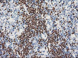 MEF2C Antibody in Immunohistochemistry (Paraffin) (IHC (P))