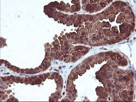 MEF2C Antibody in Immunohistochemistry (Paraffin) (IHC (P))