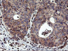 MEF2C Antibody in Immunohistochemistry (Paraffin) (IHC (P))