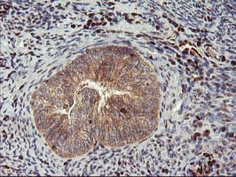 MEF2C Antibody in Immunohistochemistry (Paraffin) (IHC (P))