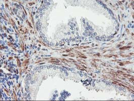 MEF2C Antibody in Immunohistochemistry (Paraffin) (IHC (P))