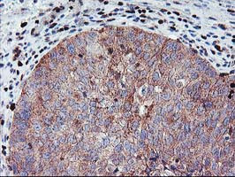 MEF2C Antibody in Immunohistochemistry (Paraffin) (IHC (P))