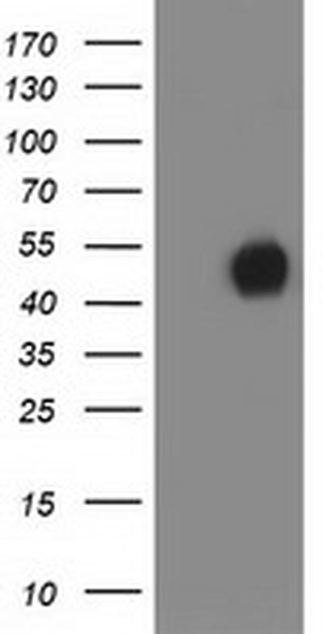 MEF2C Antibody in Western Blot (WB)